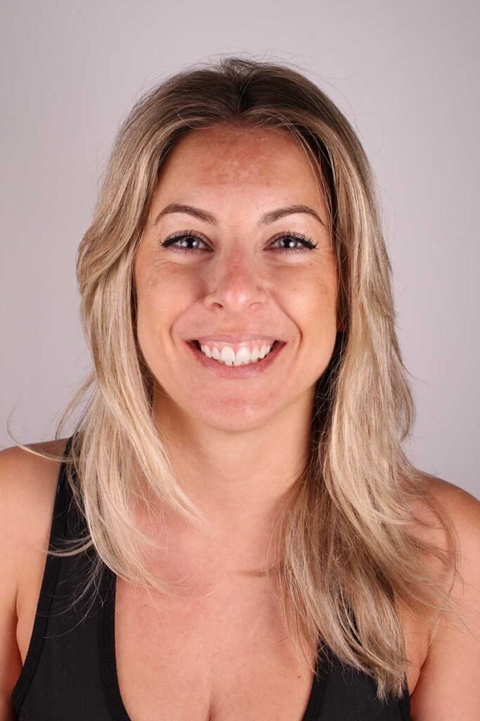 CASO.EXITO-carillas-vigo