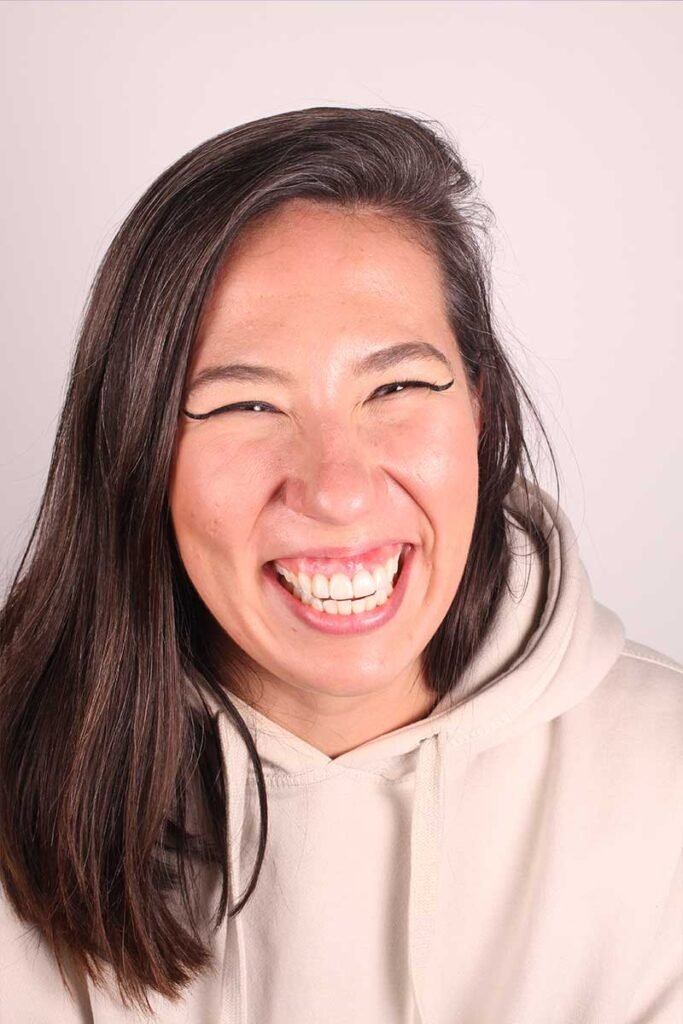 CASO.EXITO-ortodoncia-en-vigo