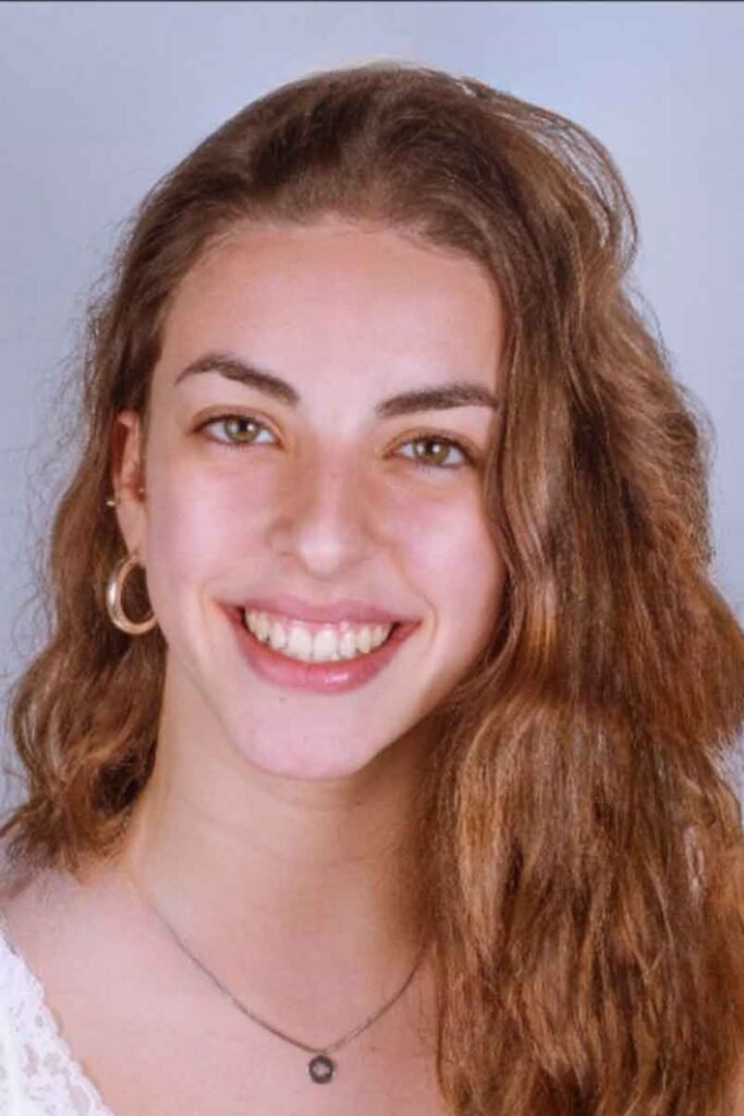 caso-exito-ortondoncia-vigo