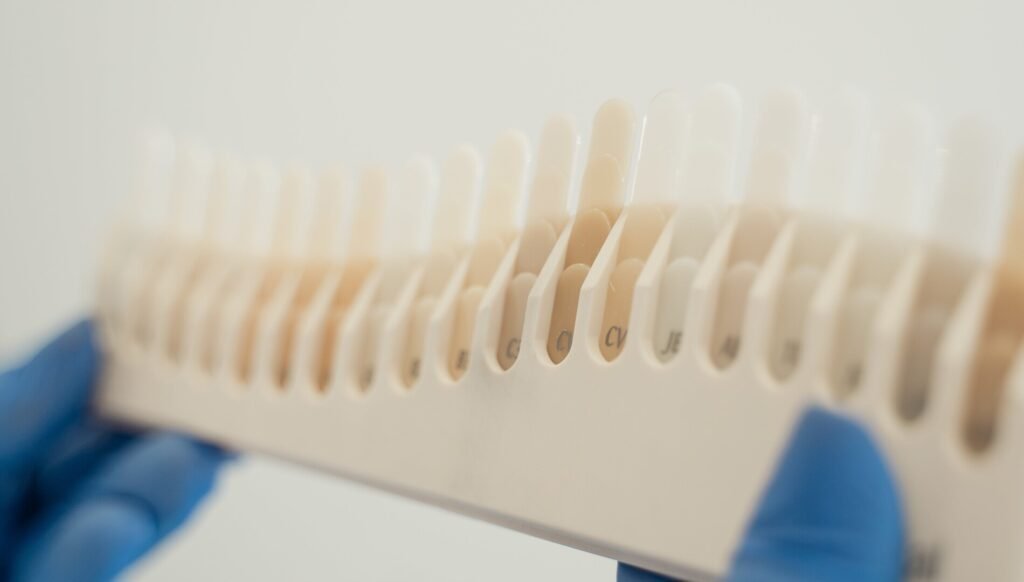 carillas dentales cuanto duran