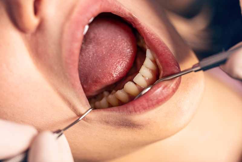 Dolor de dientes: causas, tratamientos, prevención