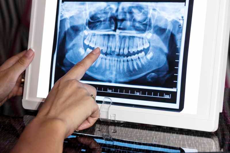 Anatomía dental: Aprende sobre la boca