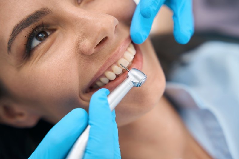 Cinco consejos para evitar caries en las muelas