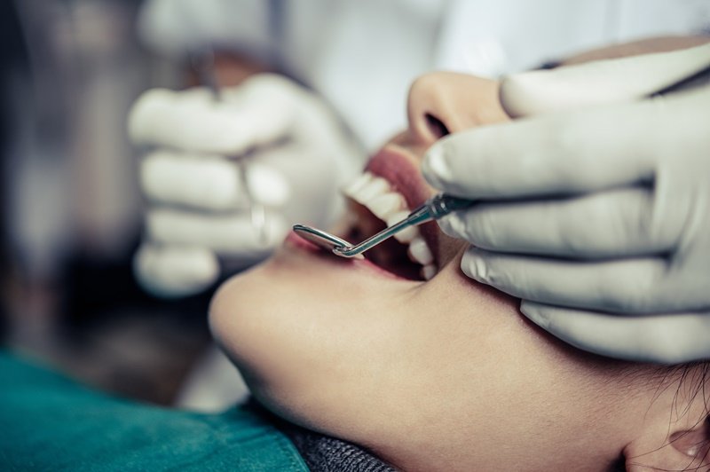 Caries: qué es y cómo tratarla eficazmente. Ante los primeros signos de una caries, es necesario consultar al dentista.