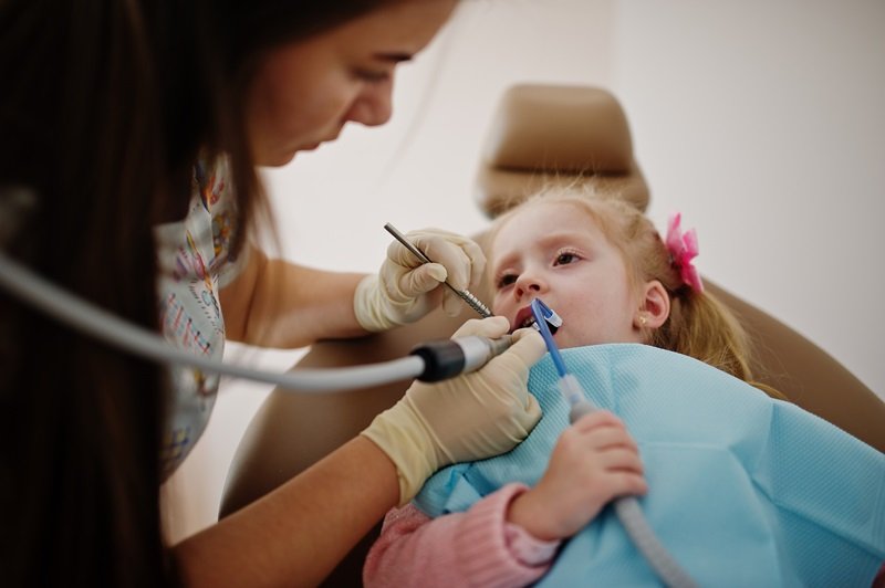 Dentista realiza tratamiento de caries en niños de 2 a 5 años