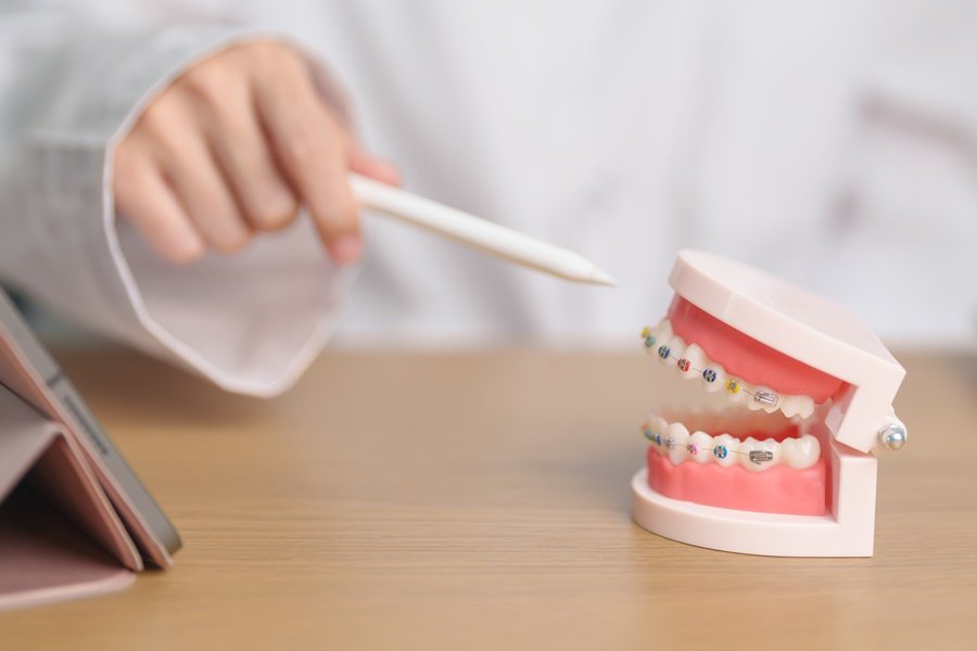 La ortodoncia en las muelas es una parte esencial del tratamiento para corregir la alineación dental y la mordida.