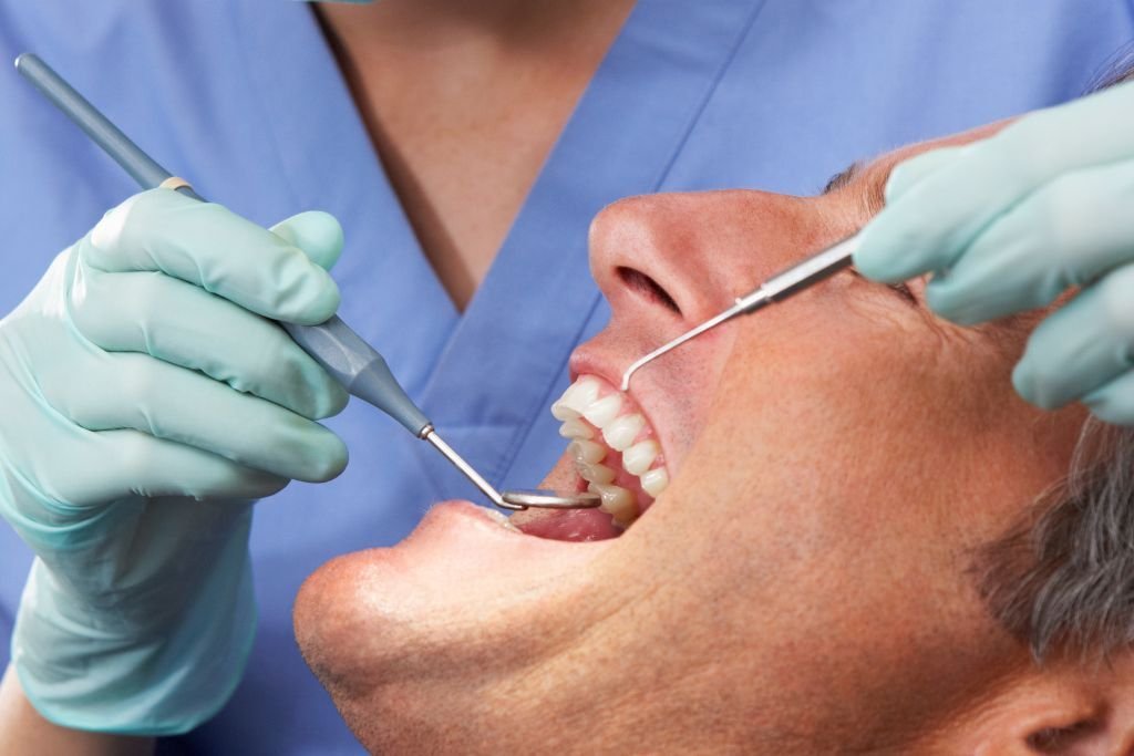 Blanqueamiento interno Vigo