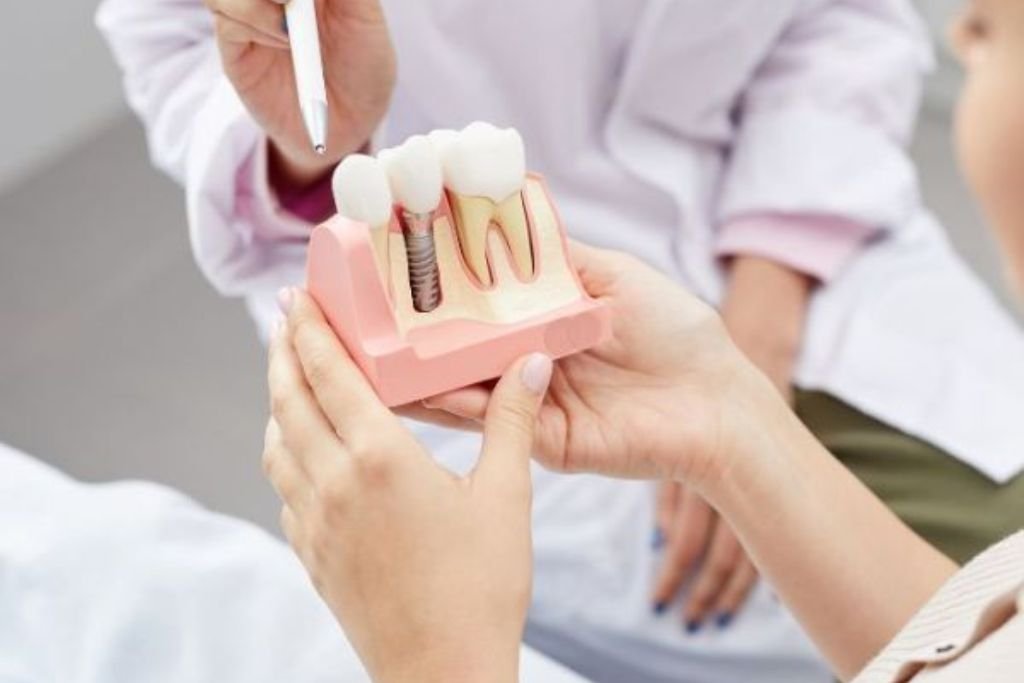 Cirugía segunda fase implante Vigo