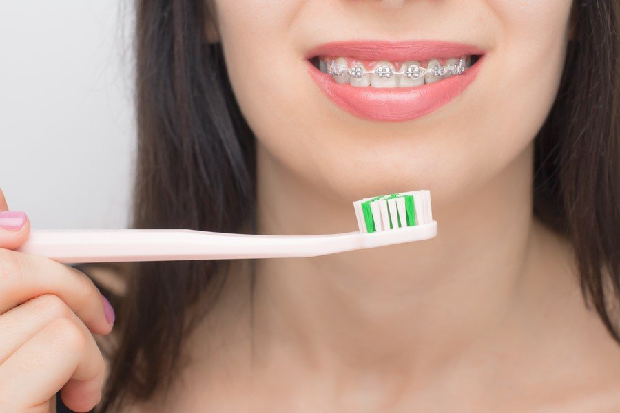 Durante los tratamientos de ortodoncia, una de las preguntas más comunes entre los pacientes es cuánto se mueven los dientes por mes