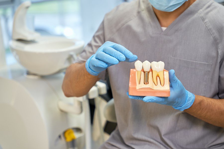 El hueco entre el implante y la encía no solo afecta la estética, sino que también puede representar un riesgo para la salud bucal del paciente.