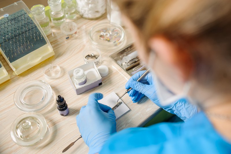 Instrumentos para realizar una endodoncia.