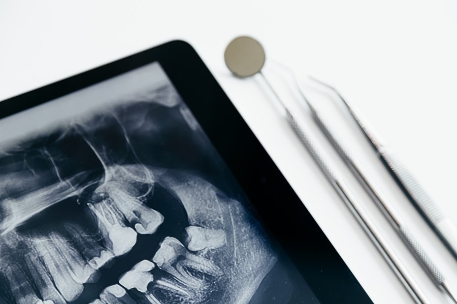 La cirugía ortognática está indicada en casos donde las alteraciones en los maxilares afectan la funcionalidad o la estética facial.