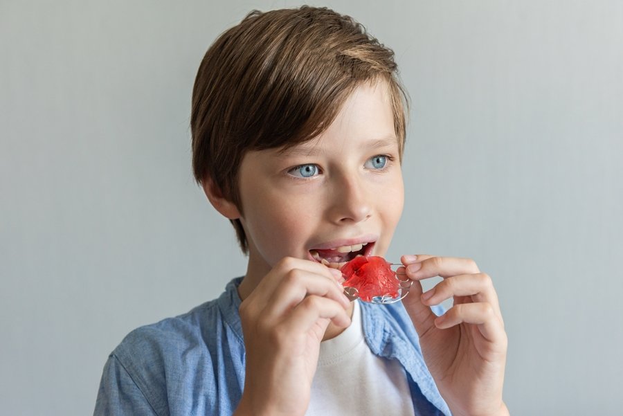 El expansor palatino es un dispositivo utilizado en ortodoncia para corregir problemas relacionados con el desarrollo del maxilar superior.