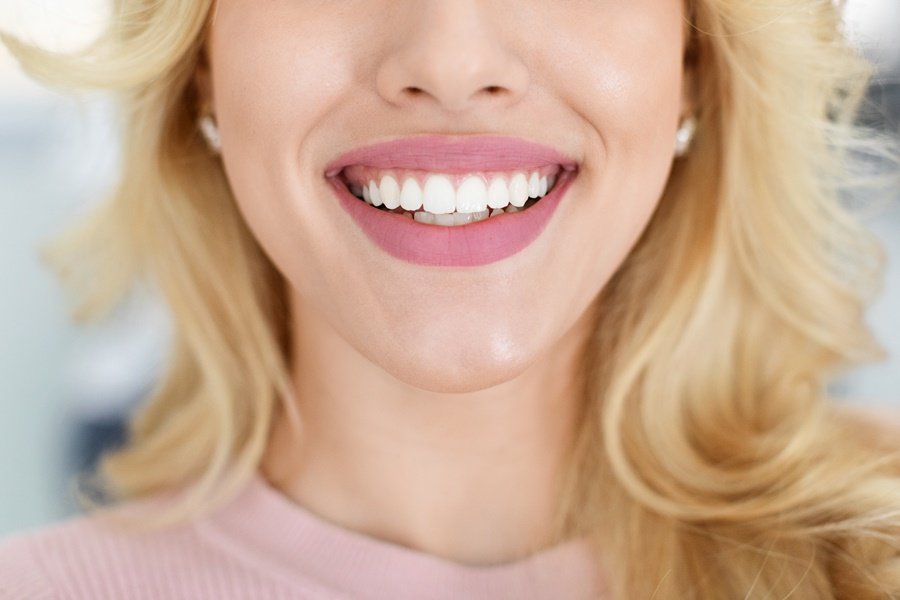 Sonrisa de una mujer con dientes blancos y saludables, resultado de una buena higiene bucodental y de seguir hábitos para proteger el esmalte dental.